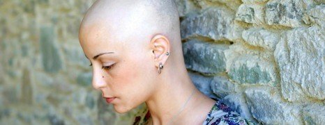 strata vlasov ako dôsledok chemoterapie